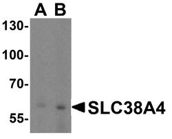 Invitrogen SLC38A4 Polyclonal Antibody 100 &mu;g; Unconjugated:Antibodies,