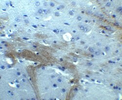 Invitrogen TNFAIP1 Polyclonal Antibody 100 &mu;g; Unconjugated:Antibodies,