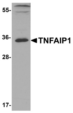 Invitrogen TNFAIP1 Polyclonal Antibody 100 &mu;g; Unconjugated:Antibodies,