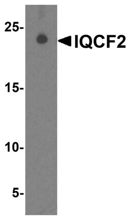Invitrogen IQCF2 Polyclonal Antibody 100 &mu;g; Unconjugated:Antibodies,