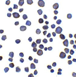 Invitrogen CHAD Polyclonal Antibody 100 &mu;g; Unconjugated:Antibodies,
