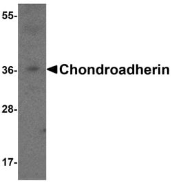 Invitrogen CHAD Polyclonal Antibody 100 &mu;g; Unconjugated:Antibodies,