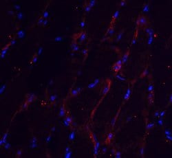 Invitrogen CHADL Polyclonal Antibody 100 &mu;g; Unconjugated:Antibodies,