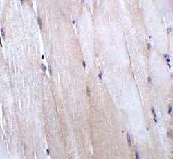 Invitrogen CHADL Polyclonal Antibody 100 &mu;g; Unconjugated:Antibodies,