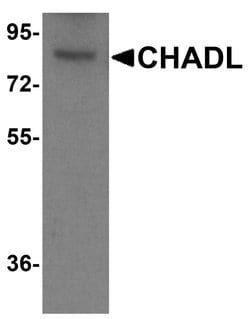 Invitrogen CHADL Polyclonal Antibody 100 &mu;g; Unconjugated:Antibodies,