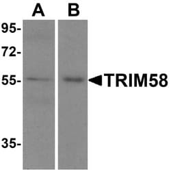 Invitrogen TRIM58 Polyclonal Antibody 100 &mu;g; Unconjugated:Antibodies,