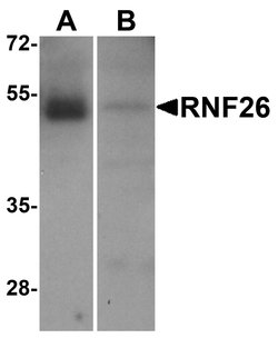 Invitrogen RNF26 Polyclonal Antibody 100 &mu;g; Unconjugated:Antibodies,