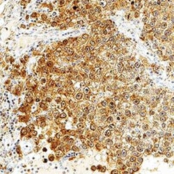 Invitrogen BAG2 Polyclonal Antibody 50 &mu;L | Buy Online | Invitrogen&trade; | Fisher Scientific