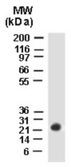 Invitrogen BAG2 Polyclonal Antibody 50 &mu;L | Buy Online | Invitrogen&trade; | Fisher Scientific