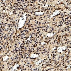 Invitrogen DEDD2 Polyclonal Antibody 50 &mu;L; Unconjugated:Antibodies,