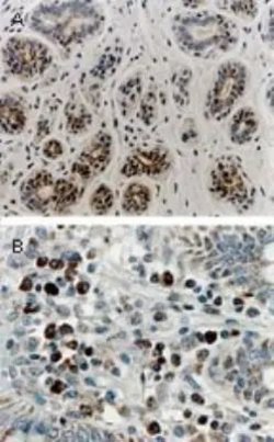 Invitrogen RIP1 Polyclonal Antibody 50 &mu;L; Unconjugated:Antibodies,