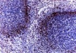 TRAF-1 Polyclonal Antibody:Antibodies, Polyclonal
