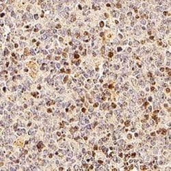 Invitrogen TRIP Polyclonal Antibody 50 &mu;L; Unconjugated:Antibodies,