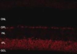 Invitrogen SHANK1 Polyclonal Antibody 100 &mu;L; Unconjugated:Antibodies,