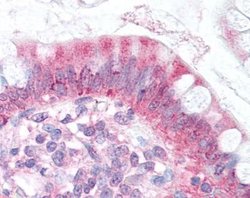 Invitrogen NPC1L1 Polyclonal Antibody 100 &mu;L; Unconjugated:Antibodies,