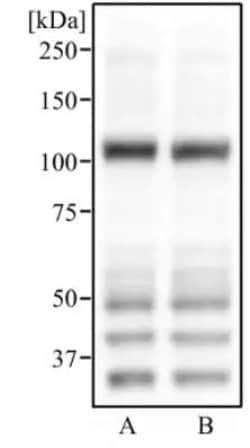 Invitrogen ABCG1 Polyclonal Antibody 100 &mu;L; Unconjugated:Antibodies,