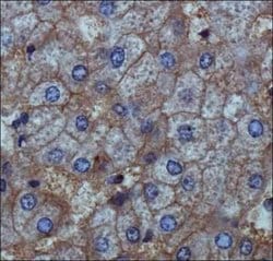ENPP1 Polyclonal Antibody:Antibodies, Polyclonal