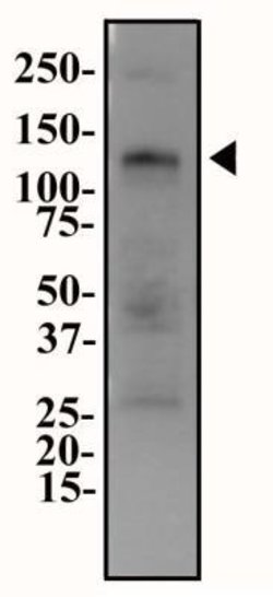 ENPP1 Polyclonal Antibody:Antibodies, Polyclonal