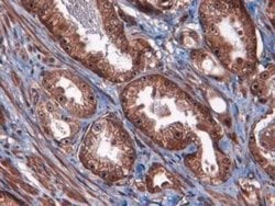 ATF3 Polyclonal Antibody:Antibodies, Polyclonal