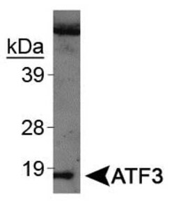 Invitrogen ATF3 Polyclonal Antibody 100 &mu;L; Unconjugated:Antibodies,