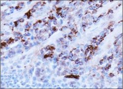 Invitrogen AMBRA1 Polyclonal Antibody 200 &mu;L | Buy Online | Invitrogen&trade; | Fisher Scientific