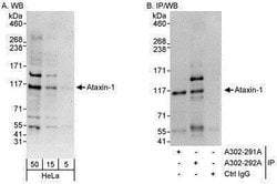 Invitrogen Ataxin 1 Polyclonal Antibody 100 &mu;L; Unconjugated:Antibodies,
