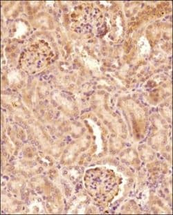 Invitrogen Pyruvate Carboxylase Polyclonal Antibody 100 &mu;L; Unconjugated:Antibodies,