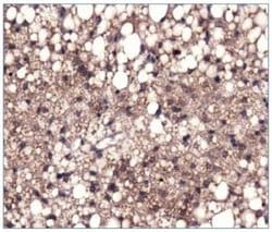 Invitrogen Pyruvate Carboxylase Polyclonal Antibody 100 &mu;L; Unconjugated:Antibodies,