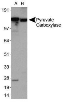 Invitrogen Pyruvate Carboxylase Polyclonal Antibody 100 &mu;L; Unconjugated:Antibodies,