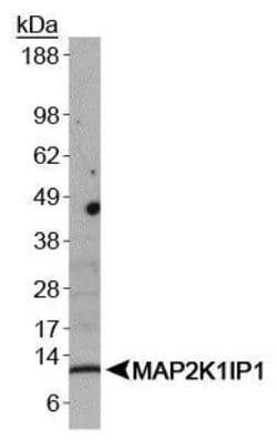 LAMTOR3 Polyclonal Antibody:Antibodies, Polyclonal