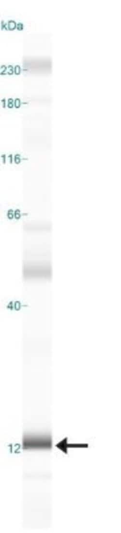 LAMTOR3 Polyclonal Antibody:Antibodies, Polyclonal