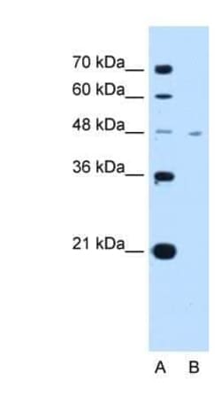 Invitrogen MCT1 Polyclonal Antibody 100 &mu;g; Unconjugated:Antibodies,