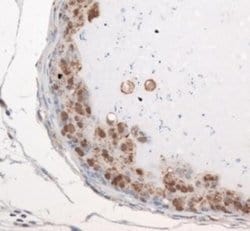 Invitrogen PMSCL1 Polyclonal Antibody 100 &mu;L; Unconjugated:Antibodies,