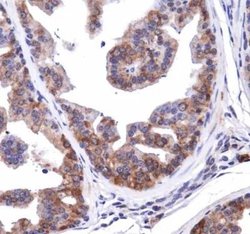Invitrogen NBR1 Polyclonal Antibody 100 &mu;L; Unconjugated:Antibodies,