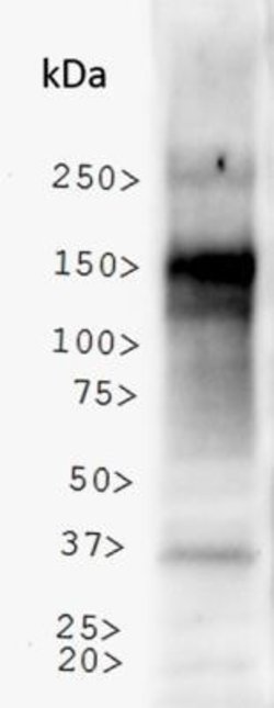 Invitrogen NBR1 Polyclonal Antibody 100 &mu;L; Unconjugated:Antibodies,