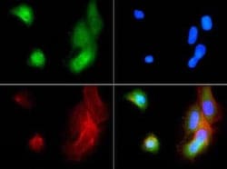 Invitrogen ABCB5 Polyclonal Antibody 100 &mu;L | Buy Online | Invitrogen&trade; | Fisher Scientific
