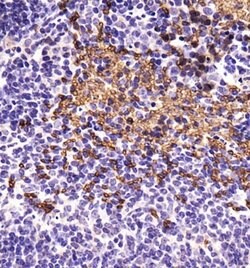 Invitrogen ABCB5 Polyclonal Antibody 100 &mu;L; Unconjugated:Antibodies,