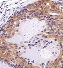 FAT4 Polyclonal Antibody:Antibodies, Polyclonal