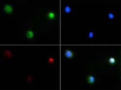 Invitrogen PIEZO2 Polyclonal Antibody 100 &mu;L | Buy Online | Invitrogen&trade; | Fisher Scientific