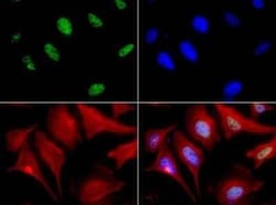 Invitrogen MBD4 Polyclonal Antibody 100 &mu;L; Unconjugated:Antibodies,