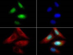 Invitrogen ZNF521 Polyclonal Antibody 100 &mu;L | Buy Online | Invitrogen&trade; | Fisher Scientific