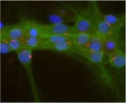 Invitrogen Adenylate Cyclase 3 Polyclonal Antibody 100 &mu;L; Unconjugated:Antibodies,