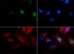 Invitrogen PLK5 Polyclonal Antibody 100 &mu;L; Unconjugated:Antibodies,