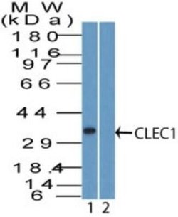 Invitrogen CLEC1A Polyclonal Antibody 100 &mu;g | Buy Online | Invitrogen&trade; | Fisher Scientific