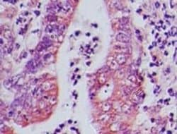Invitrogen AP3D1 Polyclonal Antibody 100 &mu;g; Unconjugated:Antibodies,