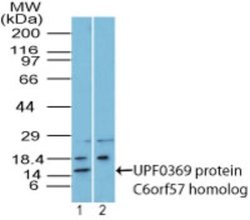 Invitrogen C6orf57 Polyclonal Antibody 100 &mu;g; Unconjugated:Antibodies,