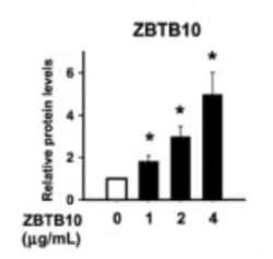 Invitrogen ZBTB46 Polyclonal Antibody 100 &mu;g; Unconjugated:Antibodies,