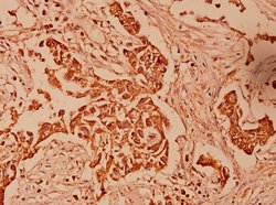 Invitrogen HSPE1 Polyclonal Antibody 100 &mu;L; Unconjugated:Antibodies,