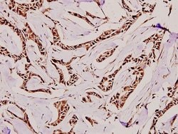 CDKN2B Polyclonal Antibody:Antibodies, Polyclonal