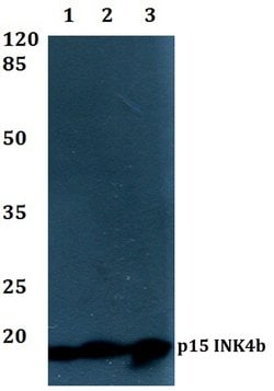 CDKN2B Polyclonal Antibody:Antibodies, Polyclonal